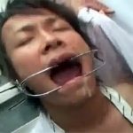 【レイプゲイ動画】病院のエレベーターで開口器をハメられて強制口内射精させられるノンケの爽やかサラリーマンw